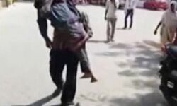 योगी राज: पिता बेटे का शव कंधे पर उठाकर ले जाने को मजबूर : देखें वीडियो