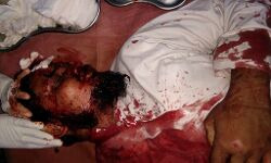 भाजपा शासित झारखण्ड में मौलाना अज़हरुल इस्लाम की जय श्री राम नहीं बोलने पर हॉकी और डंडे से पिटाई, हालत नाज़ुक