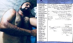 अभी अभी: योगी के गढ़ में ताड़ताई गोलियां, डॉ कफील के भाई पर जानलेवा हमला, अज्ञात हमलवारों ने मारी गोली