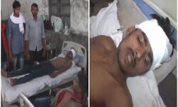 योगीराज: भाजपा नेता की गुंडई, भ्रष्टाचार का विरोध करने पर बुरी तरह पीटा