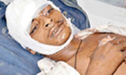 योगीराज: सिपाहियों ने हजार रुपये न देने पर ट्रेन से फेंका, युवक गंभीर रूप से घायल