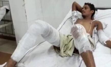 योगी राज: दबंगों से परेशान एक परिवार के 5 लोगों ने की सामूहिक आत्मदाह की कोशिश, पुलिस पर लगे गंभीर आरोप