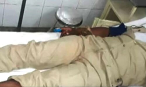योगी के गढ़ गोरखपुर में ख़ाकी लाचार, दबंगों ने पुलिसकर्मी रौंदा, टूटा पैर