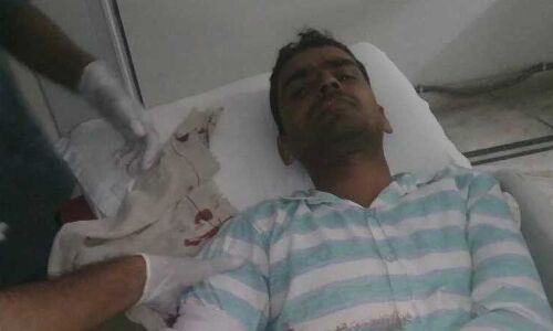 योगीराज: आगरा में लूट की वारदात से दहशत, सर्राफा कारोबारी को गोली मार, लाखों लूटे !