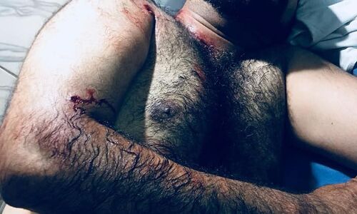 उत्तर प्रदेश: डा. कफील के भाई का देर रात हुआ आपरेशन, गले में फंसी गोली निकाली गई उत्तर प्रदेश: डा. कफील के भाई का देर रात हुआ आपरेशन, गले में फंसी गोली निकाली गई