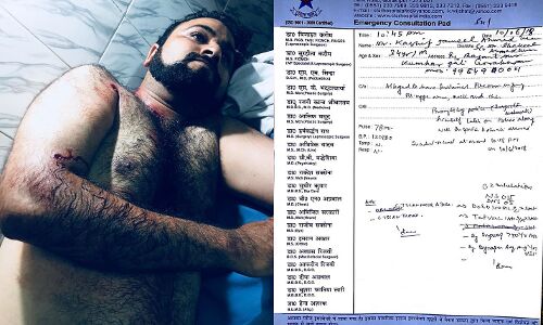 अभी अभी: योगी के गढ़ में ताड़ताई गोलियां, डॉ कफील के भाई पर जानलेवा हमला, अज्ञात हमलवारों ने मारी गोली अभी अभी: योगी के गढ़ में ताड़ताई गोलियां, डॉ कफील के भाई पर जानलेवा हमला, अज्ञात हमलवारों ने मारी गोली