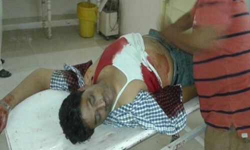 योगिराज: गोरखपुर में गुंडों का आतंक, कारोबारी को गोलियों से भुना:पढ़ें पूरी खबर