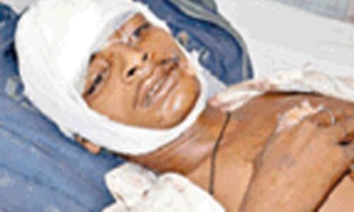 योगीराज: सिपाहियों ने हजार रुपये न देने पर ट्रेन से फेंका, युवक गंभीर रूप से घायल