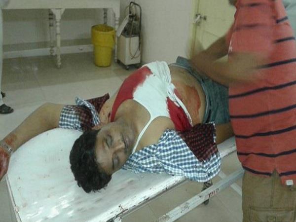 योगिराज: गोरखपुर में गुंडों का आतंक, कारोबारी को गोलियों से भुना:पढ़ें पूरी खबर