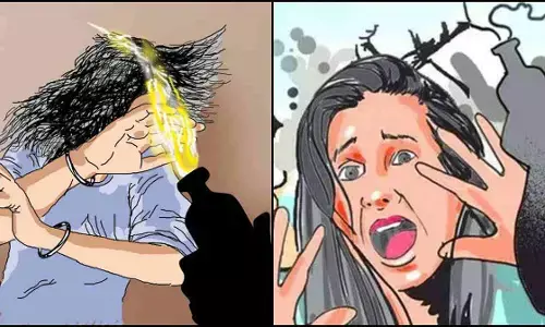 बेटियों के लिए नर्क बना उत्तर प्रदेश ! गोंडा में 3 दलित नाबालिग बेटियों पर सोते वक्त तेजाब फेंका