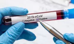 देश में कोरोना के मामले 73 लाख के पार, 24 घंटे में सामने आए 67 हजार से अधिक मामले, 680 मरीजों की गई जान