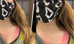 दिल्ली : कश्मीरी लड़की को मकान मालकिन ने पीटा, पुलिस के सामने कहा आतंकवादी, ये है पूरा मामला दिल्ली : कश्मीरी लड़की को मकान मालकिन ने पीटा, पुलिस के सामने कहा आतंकवादी, ये है पूरा मामला