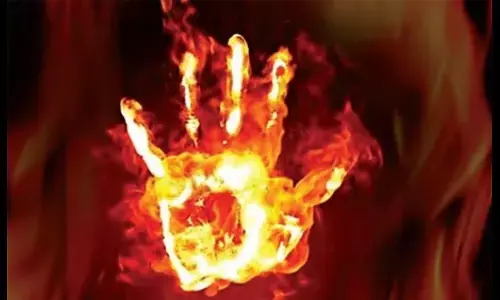 amethi Minor girl harassed by molestation set herself on fire in bathroom