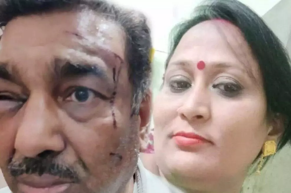 Wife beat up husband, Thanedar said- blow the conch, this is the whole matter