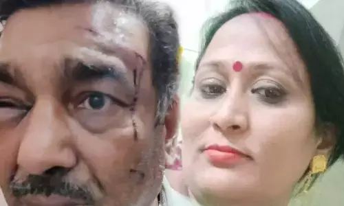 Wife beat up husband, Thanedar said- blow the conch, this is the whole matter