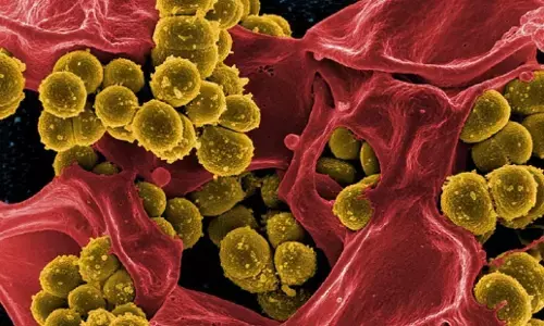 अब देश में ब्लैक फंगस का प्रकोप, इन 13 राज्यों में जानलेवा बीमारी ने दी दस्तक, जानें इसके बारे में सबकुछ अब देश में ब्लैक फंगस का प्रकोप, इन 13 राज्यों में जानलेवा बीमारी ने दी दस्तक, जानें इसके बारे में सबकुछ