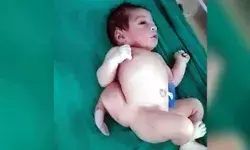 चार पैर और तीन हाथ वाले बच्चे को देखकर डॉक्टर हुए हैरान, देखने उमड़ी लोगों की भीड़ चार पैर और तीन हाथ वाले बच्चे को देखकर डॉक्टर हुए हैरान, देखने उमड़ी लोगों की भीड़