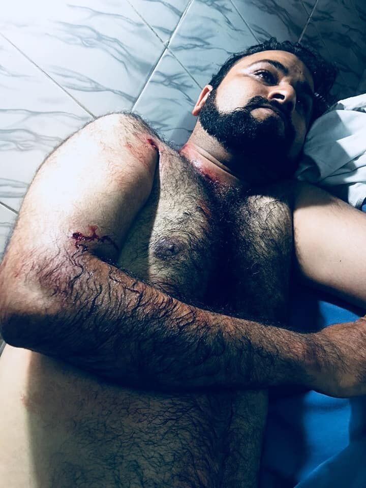 उत्तर प्रदेश: डा. कफील के भाई का देर रात हुआ आपरेशन, गले में फंसी गोली निकाली गई उत्तर प्रदेश: डा. कफील के भाई का देर रात हुआ आपरेशन, गले में फंसी गोली निकाली गई