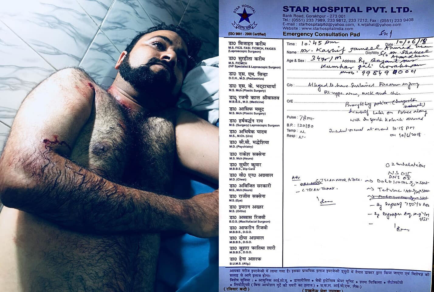 अभी अभी: योगी के गढ़ में ताड़ताई गोलियां, डॉ कफील के भाई पर जानलेवा हमला, अज्ञात हमलवारों ने मारी गोली अभी अभी: योगी के गढ़ में ताड़ताई गोलियां, डॉ कफील के भाई पर जानलेवा हमला, अज्ञात हमलवारों ने मारी गोली